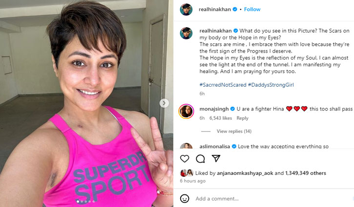 Hina Khan shared photos of her chemotherapy scars