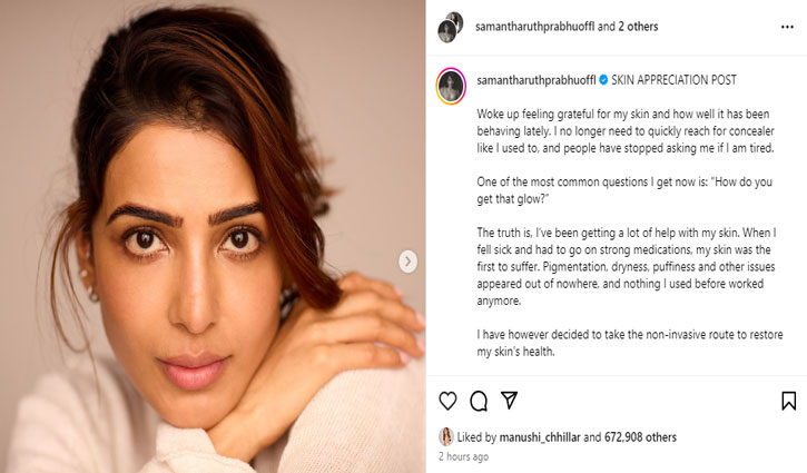 Samantha Ruth Prabhu shares her skin care story, says 'skin health is not just for beauty'